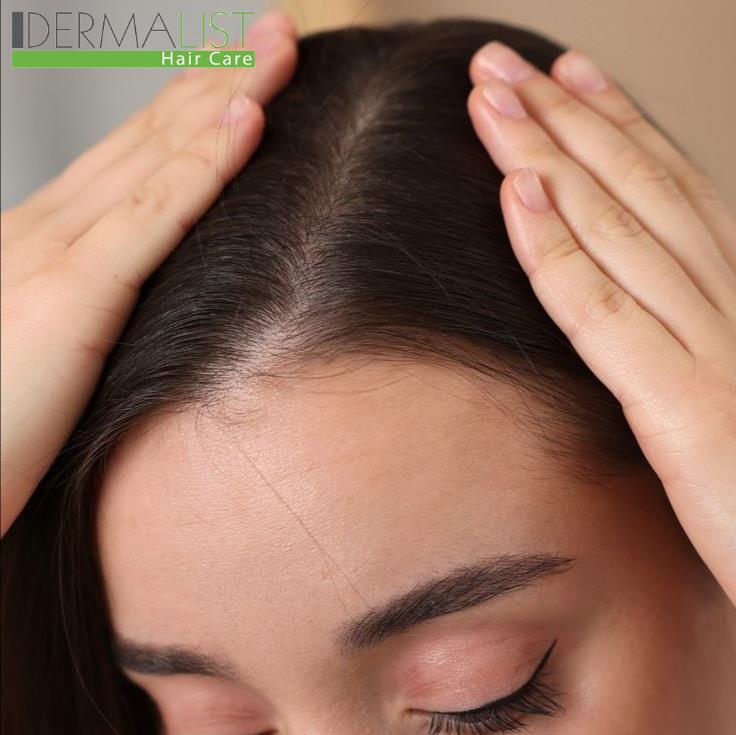 پوست سر چرب و موی خشک: درمان تضاد چر‌بی و خشکی در موها